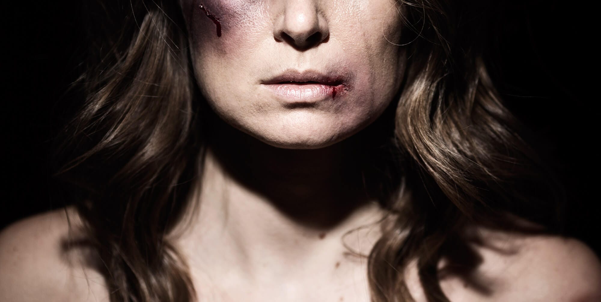 SNW-Website-Battle-Scars-2000x1005